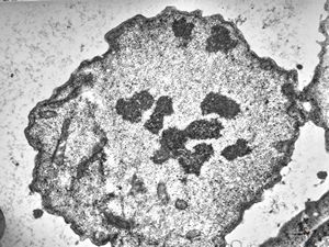 M,62y. | mitosis - plasmocytoma M,62y. | mitosis - plasmocytoma